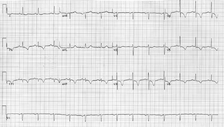 ECG · SCA — USP 2026