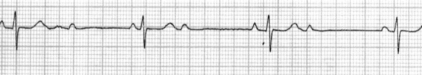 ECG · 12 derivações — USP 2026